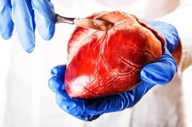 Trasplantan en Italia por primera vez un corazón que había dejado de latir 20 minutos