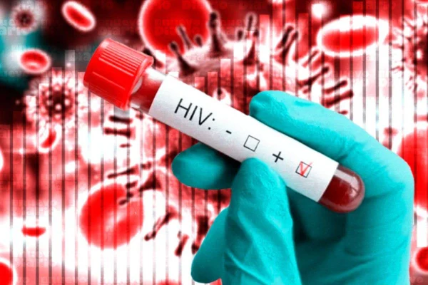 República Domicana registra 3,600 casos de VIH cada año