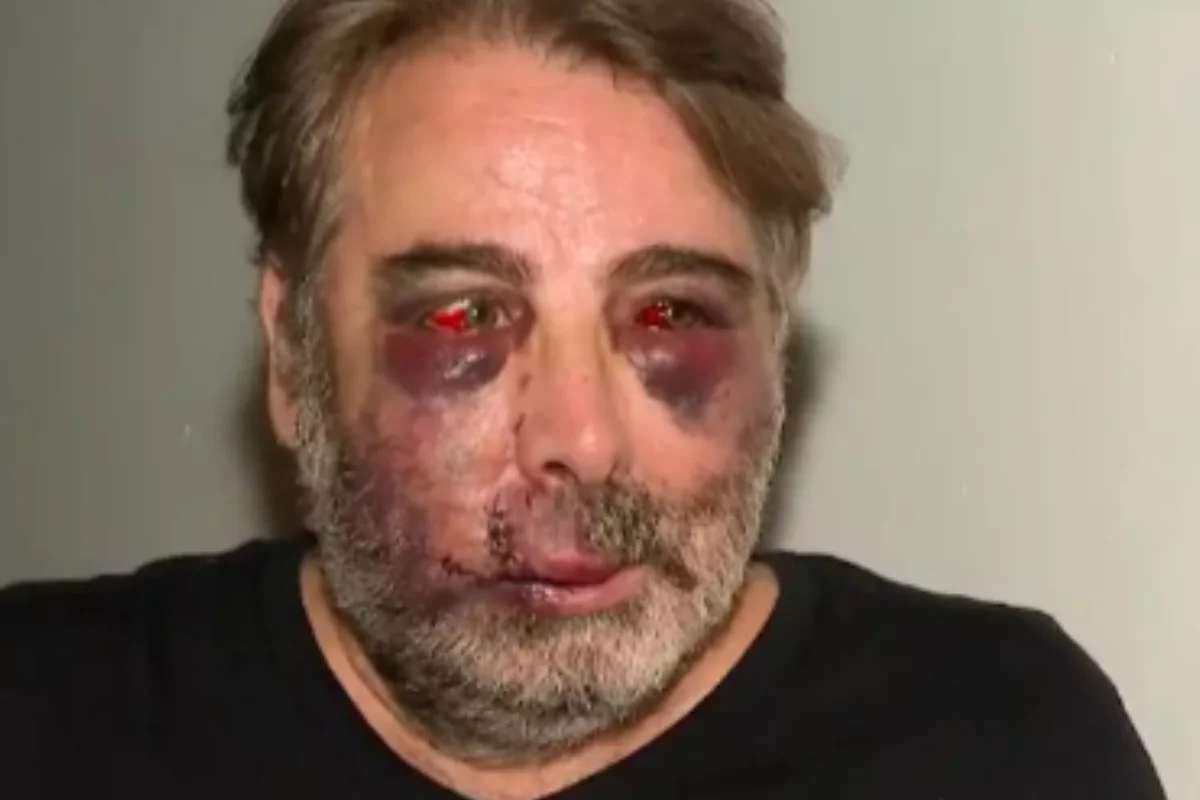 ¡Ni en su casa manda! Hombre es golpeado por jóvenes tras pedir que bajen la música