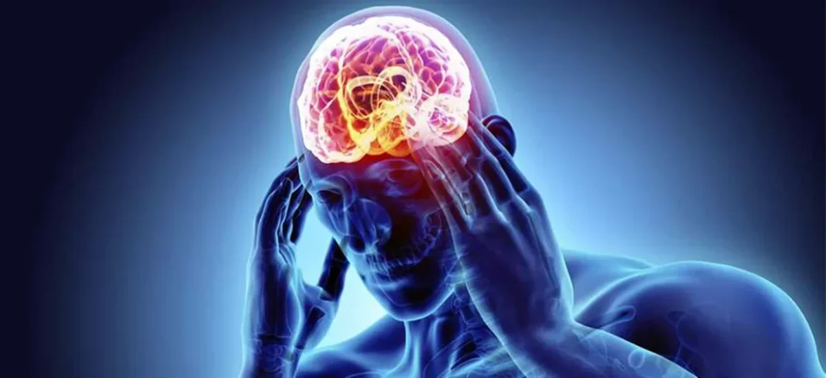 El país registra entre 22,000 y 26,000 accidentes cerebrovasculares cada año