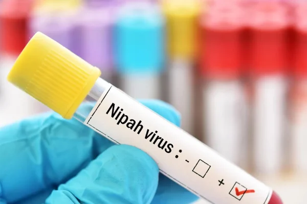 La OMS califica como bajo riesgo expansión del virus Nipah
