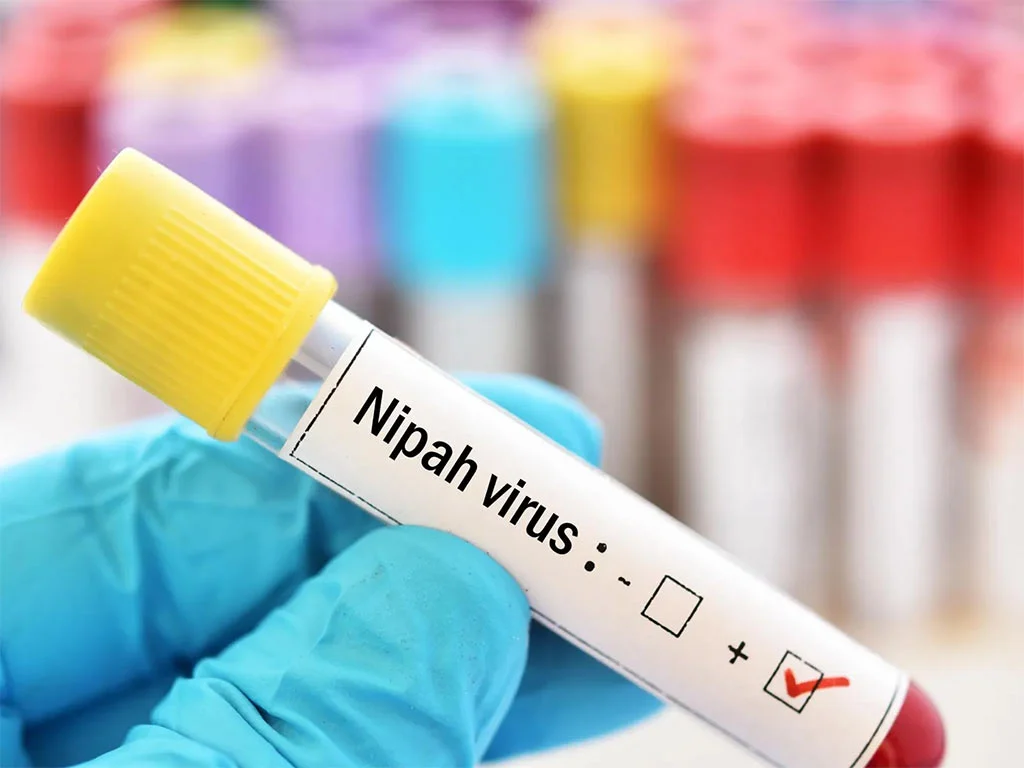 La OMS califica como bajo riesgo expansión del virus Nipah